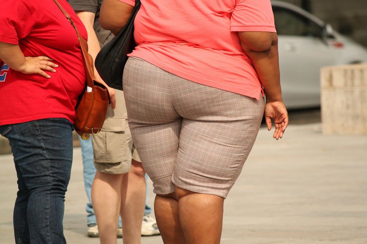 Adipositas: Menschen mit starkem Übergewicht
